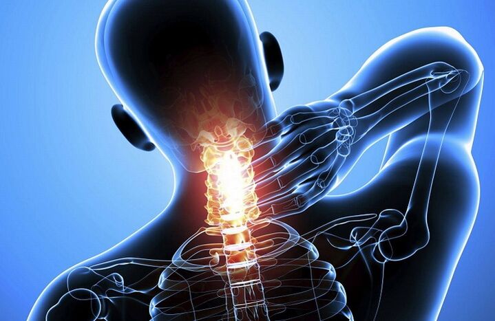 Osteochondroza cervicală