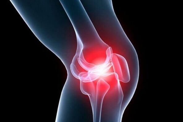 Osteoartrita articulației genunchiului