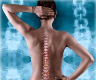 Ilustrație a coloanei posterioare