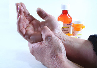 Metode de tratare a artritei și osteoartritei
