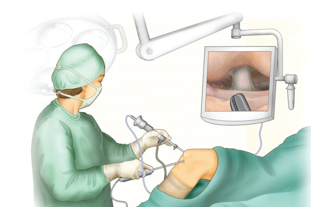 Chirurgie la genunchi