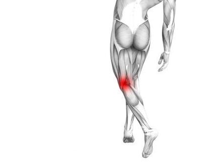 Osteoartrita articulației genunchiului
