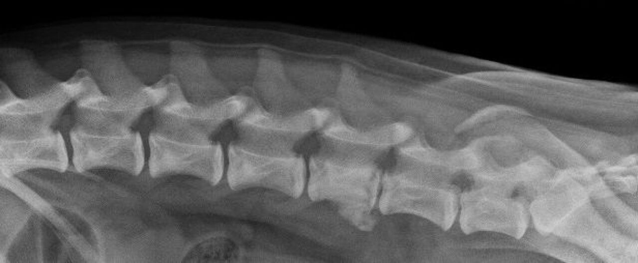 Manifestări ale osteocondrozei coloanei vertebrale toracice pe radiografie