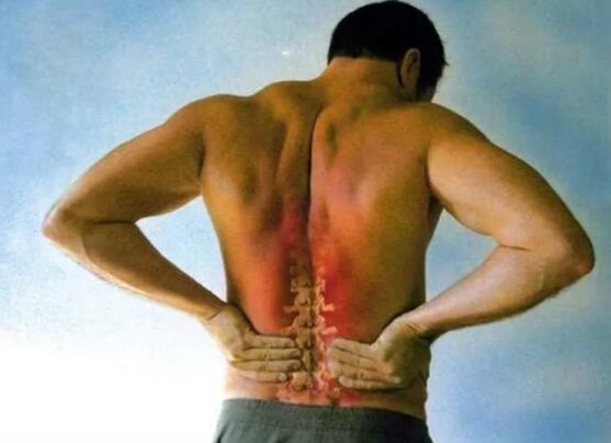 Durere pentru osteochondroză lombară